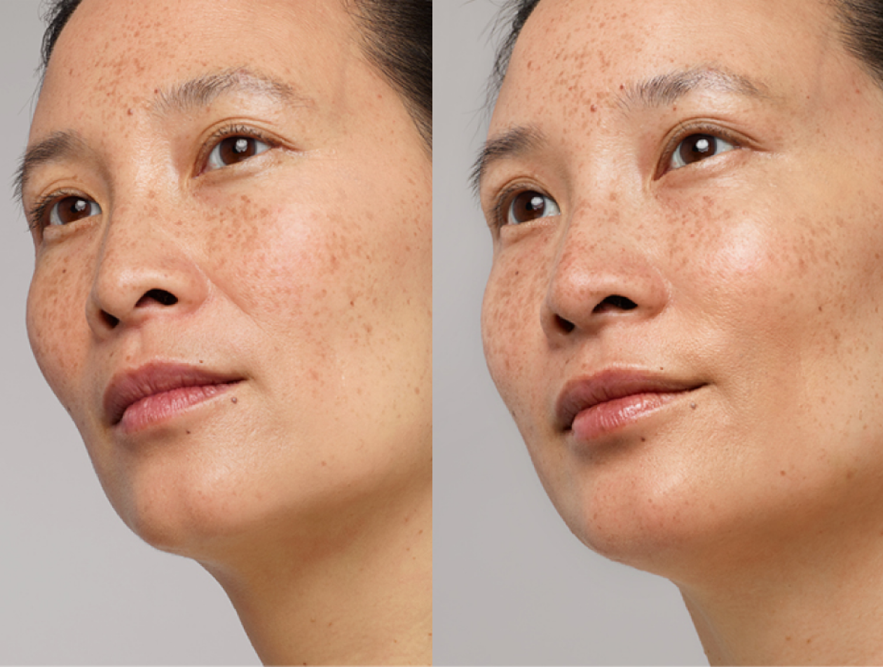 Elaine GoodSkin treatments