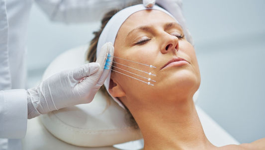 Woman receiving PDO thread lift treatment to improve facial contour, lift sagging skin, and support collagen production.