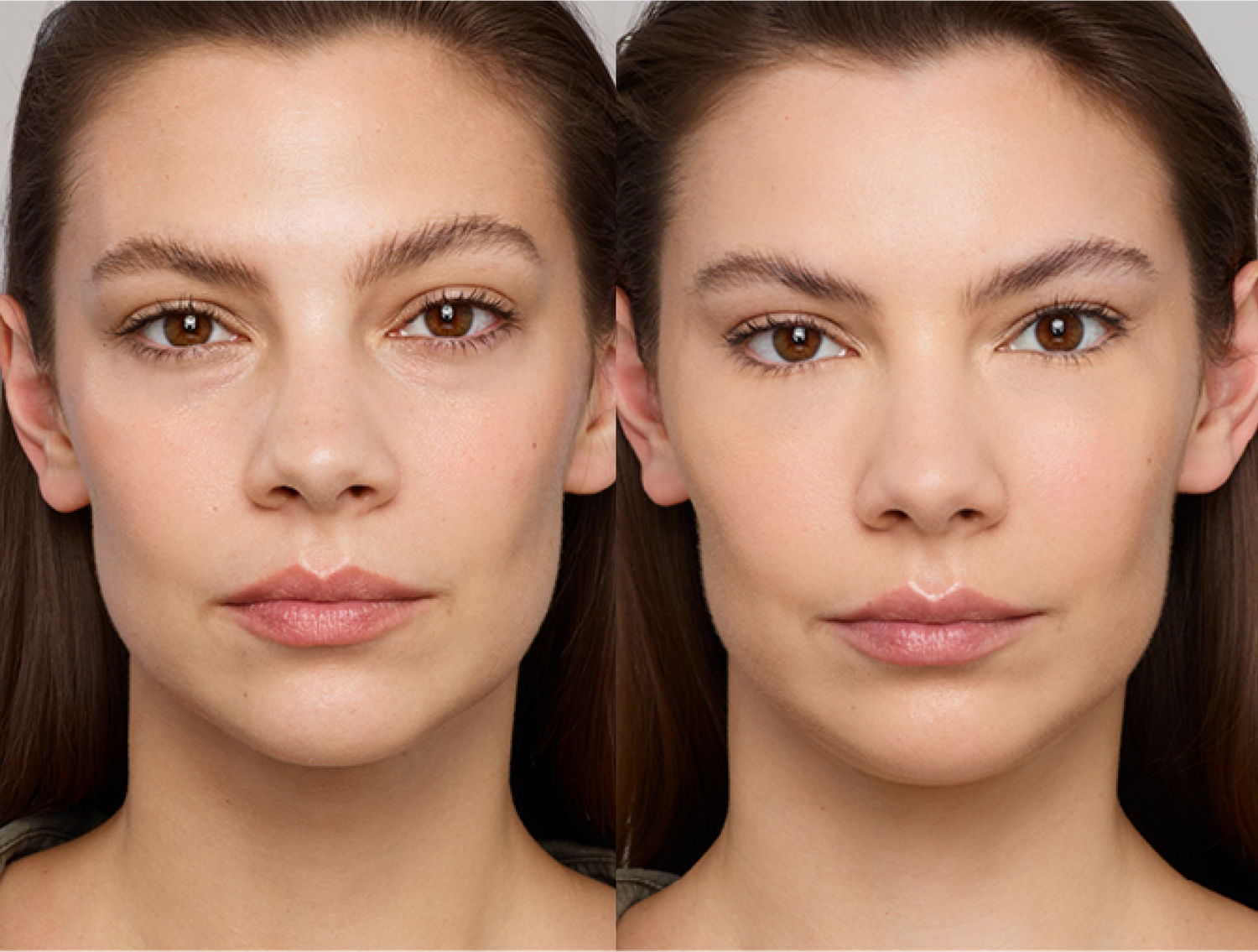 Skin Treatment