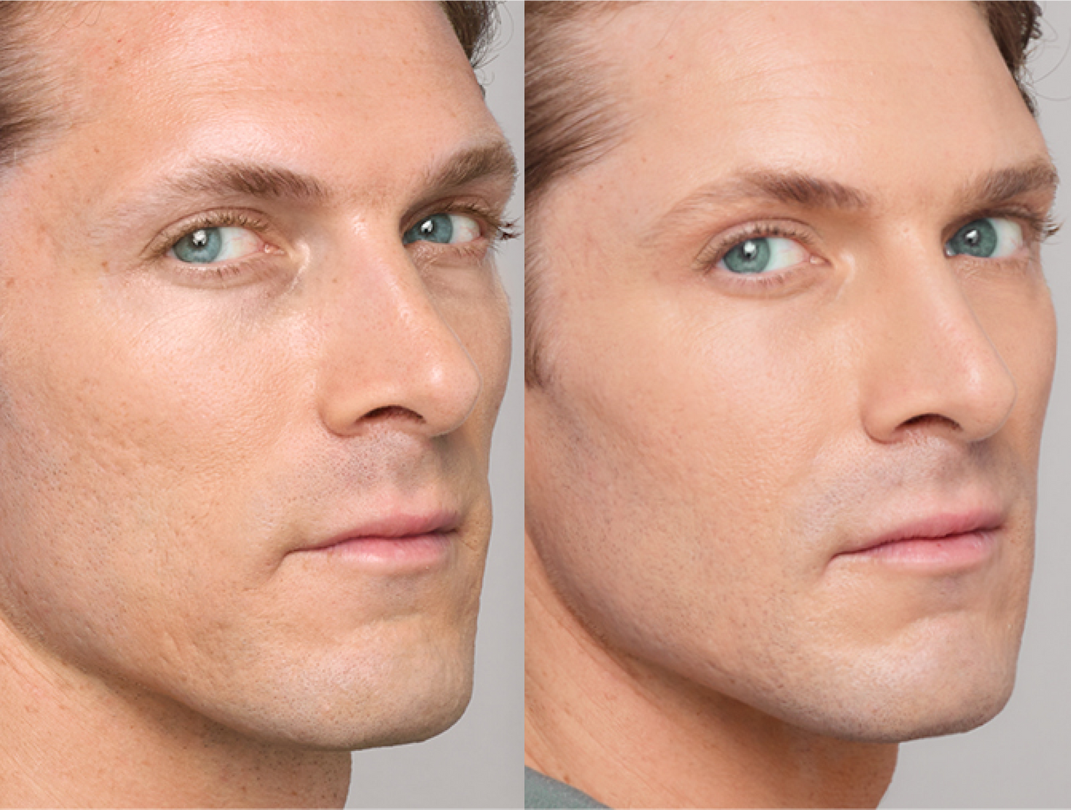 Men Facial Treatment